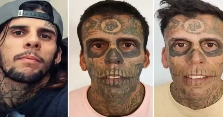 Leandro de Souza apaga suas tatuagens