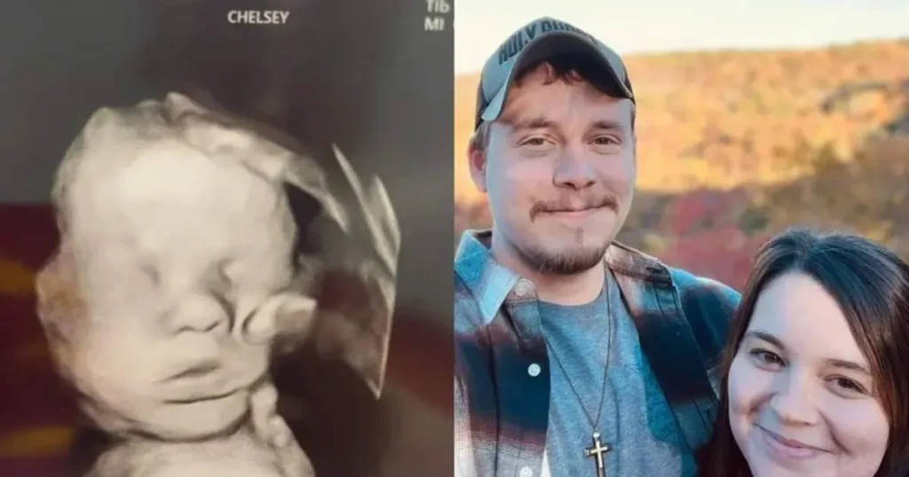 Foto de ecografía con la supuesta mano de Dios