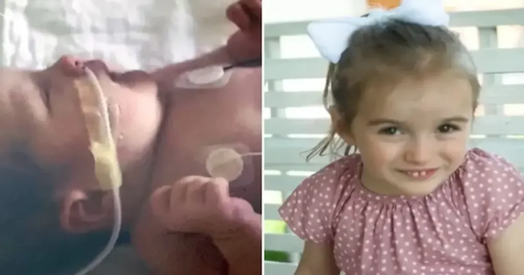 . Los médicos diagnosticaron a la bebé con encefalopatía hipóxico-isquémica (EHI), una grave lesión cerebral causada por la falta de oxígeno durante el parto.