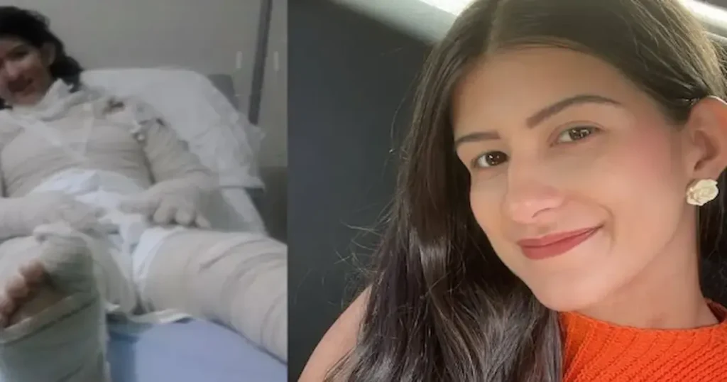 En segundos, una gran llama los envolvió. La mujer intentó apagar el fuego por su cuenta, pero solo logró que se extendiera