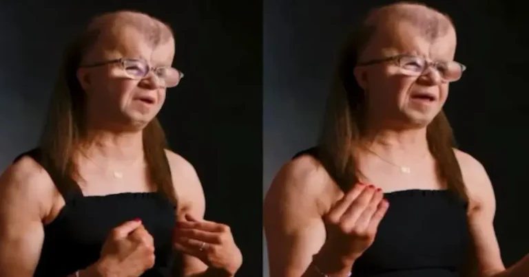 Una joven estadounidense identificada como Kenzie ha conmovido a miles de personas tras compartir su testimonio de vida al enfrentar el síndrome progeroide de Fontaine, una enfermedad