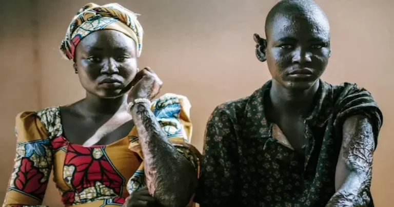 Dos hermanos sobrevivientes de la violencia del grupo extremista Boko Haram han conmovido al mundo tras compartir su decisión de perdonar