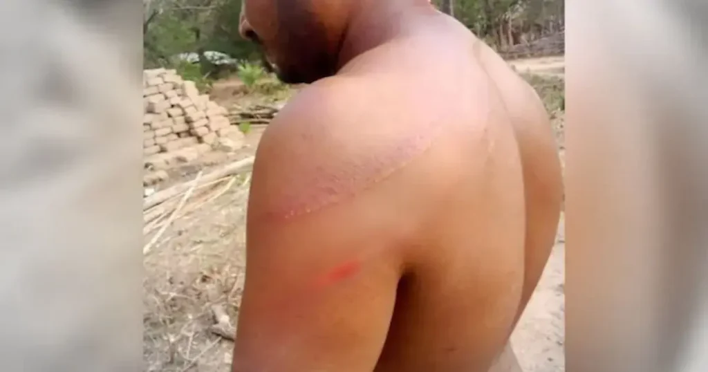 Un pastor cristiano y su familia fueron brutalmente atacados durante dos noches consecutivas en una aldea del centro de India, luego de ser acusados