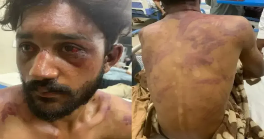 Un joven cristiano de 17 años fue brutalmente golpeado por un grupo de hombres en Pakistán después de intentar
