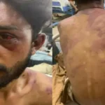 Un joven cristiano de 17 años fue brutalmente golpeado por un grupo de hombres en Pakistán después de intentar